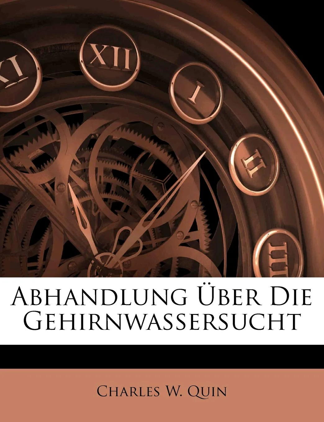 Abhandlung ber Die Gehirnwassersucht (Afrikaans Edition)