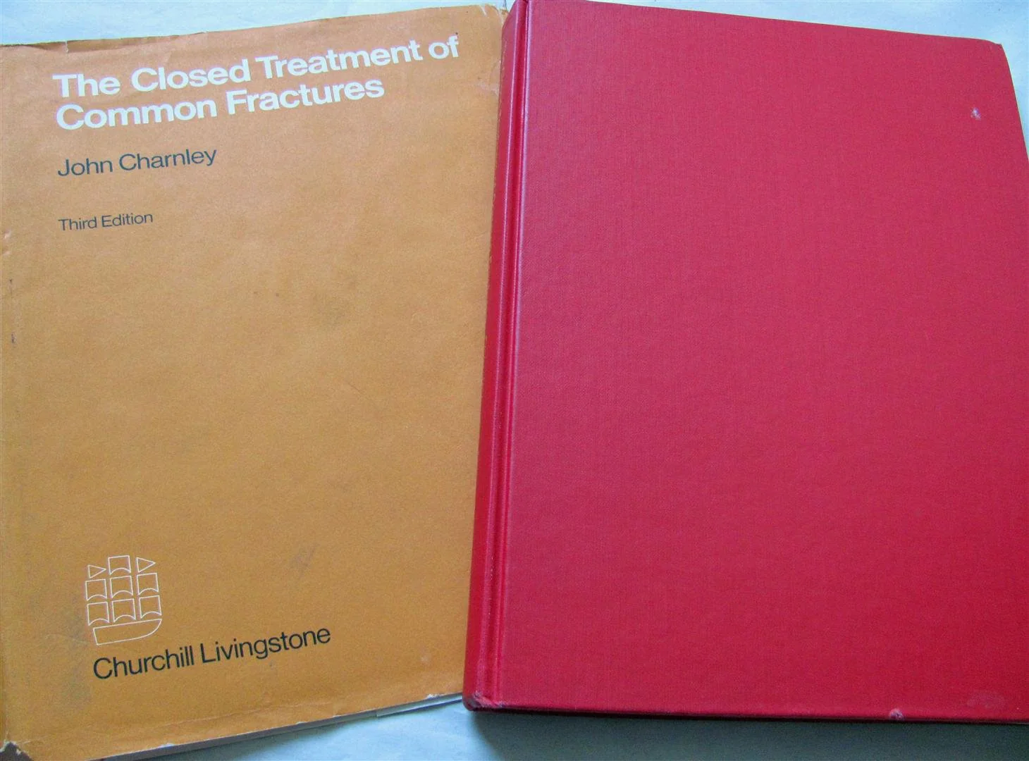 Closed Treatment of Common Fractures