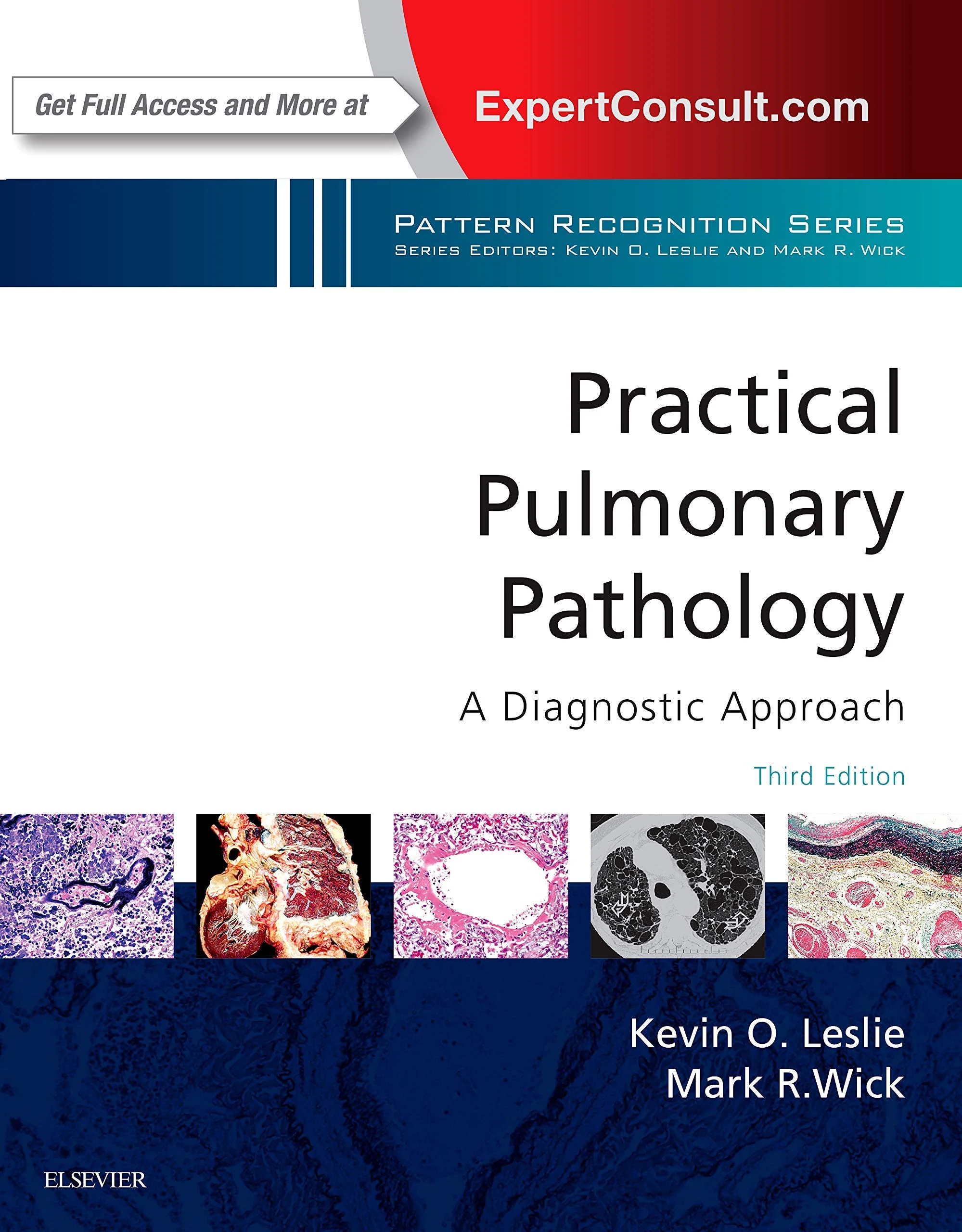 Practical Pulmonary Pathology: A Diagnostic Approach: A Volume in the Pattern Recognition Series